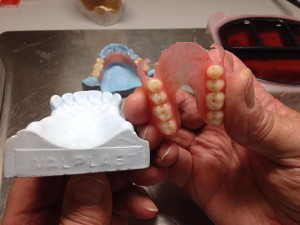 Flexible Partial Dentures, valplast
