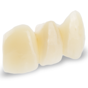 ArgenZ ST ML Zirconia Dental Crown