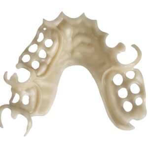 DuraCetal Removable Partial Denture Framework
