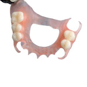 flexi partial denture