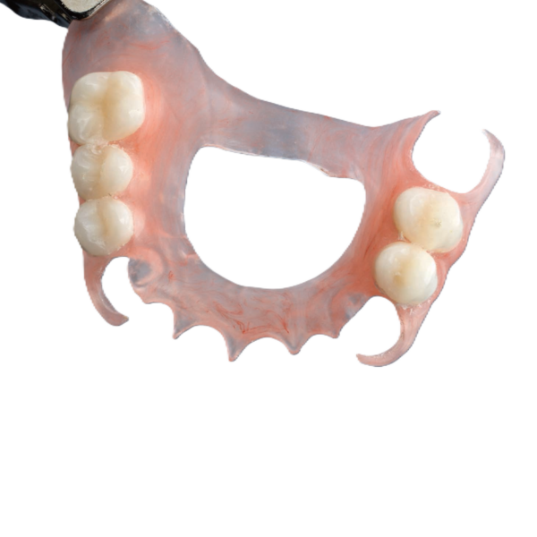 flexi partial denture